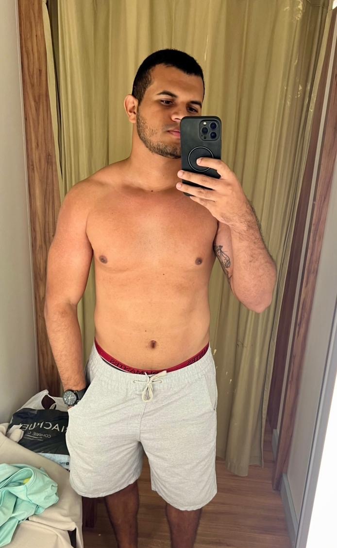 Foto de depois - evolução do paciente 3